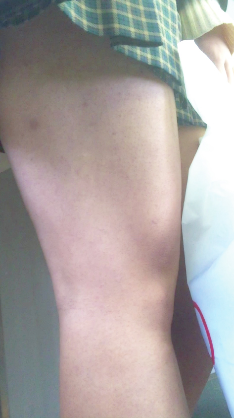 卑猥なミニスカから丸ごと露出された質感生脚